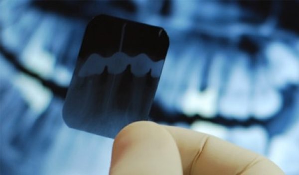 Radiologie Dentara