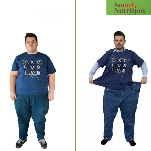 Record la pierderea în greutate în clinica Smart Nutrition - Un tânăr de 26 de ani a slăbit 80 de kilograme fără chirurgie bariatrică