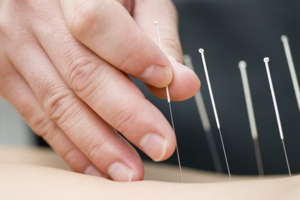 Cabinete Acupunctura-Presopunctura