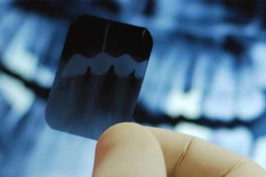 Radiologie Dentara