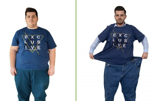 Record la pierderea în greutate în clinica Smart Nutrition - Un tânăr de 26 de ani a slăbit 80 de kilograme fără chirurgie bariatrică